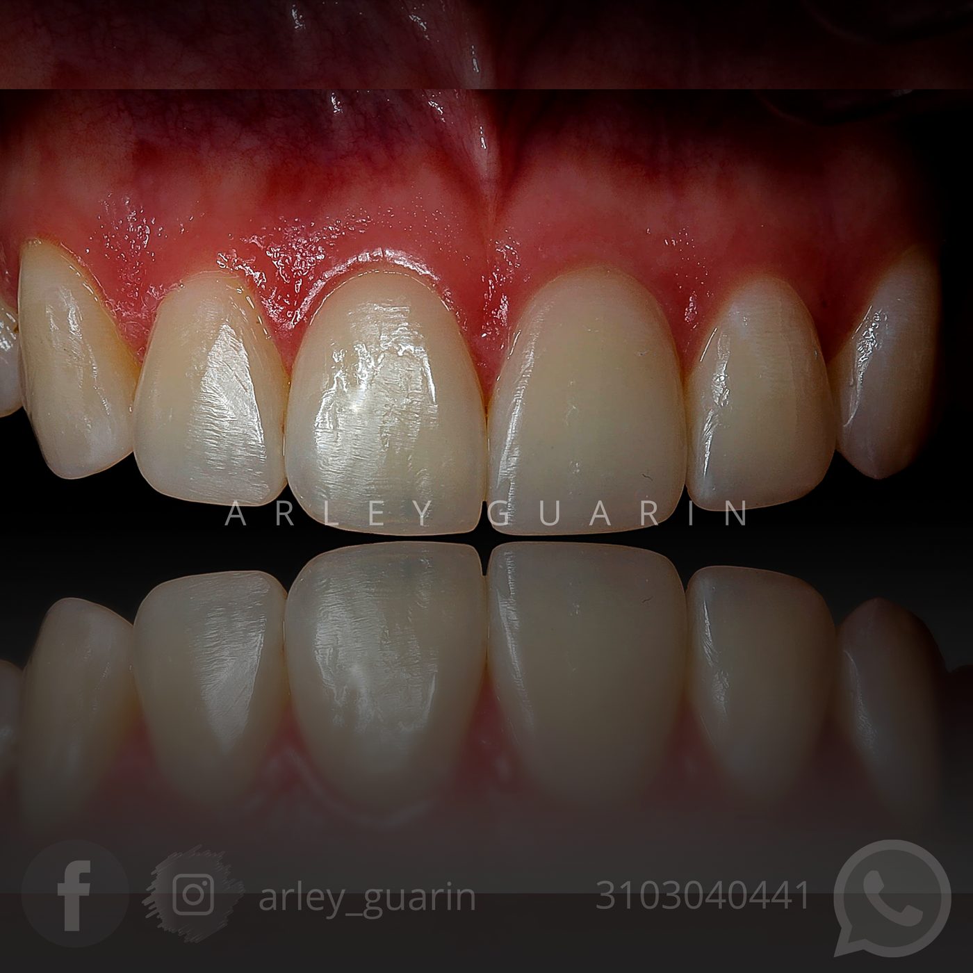 Operatoria dental estética
